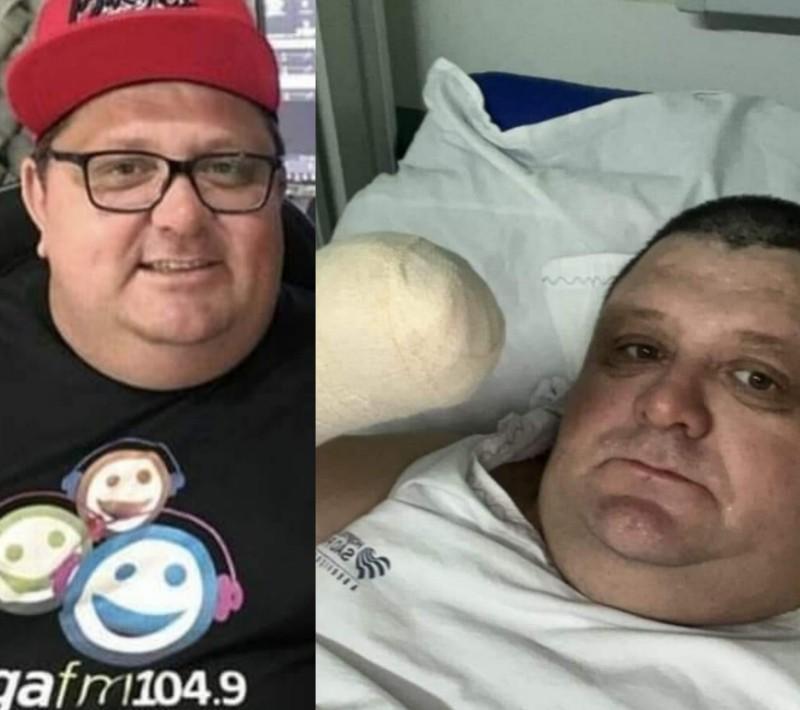 humorista Pilha perde a mão em acidente com fogo de artifício