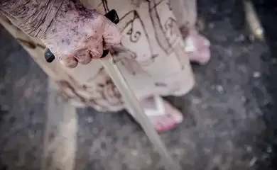 Ortopedistas alertam para risco de queda de idosos