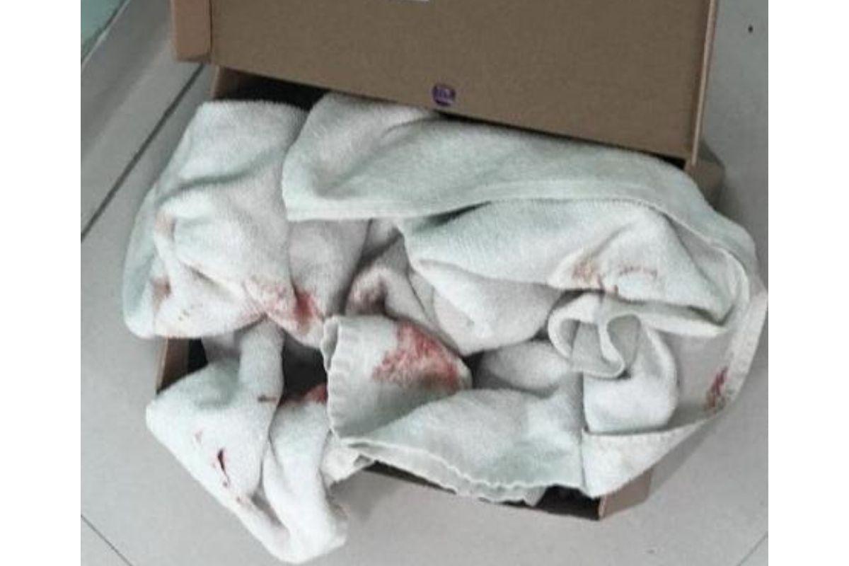 Adolescente força aborto e transporta feto em caixa de sapatos em Jaraguá do Sul