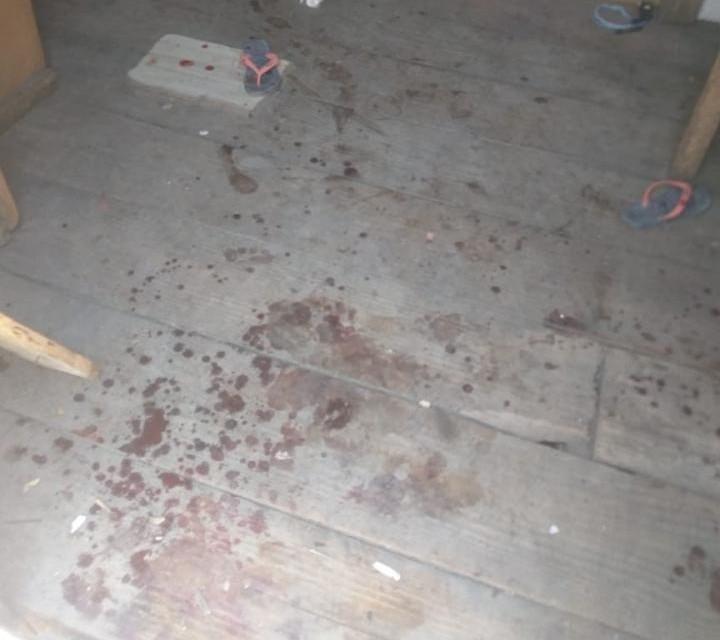 Mulher é atacada com golpes de foice em Joinville