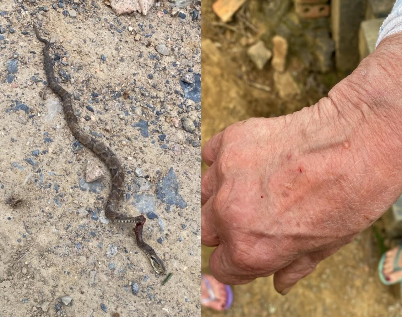 ALERTA: mulher é picada por jararaca enquanto cuidava do jardim em Rio do Sul