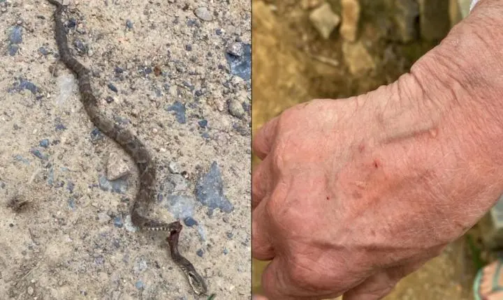 ALERTA: mulher é picada por jararaca enquanto cuidava do jardim em Rio do Sul