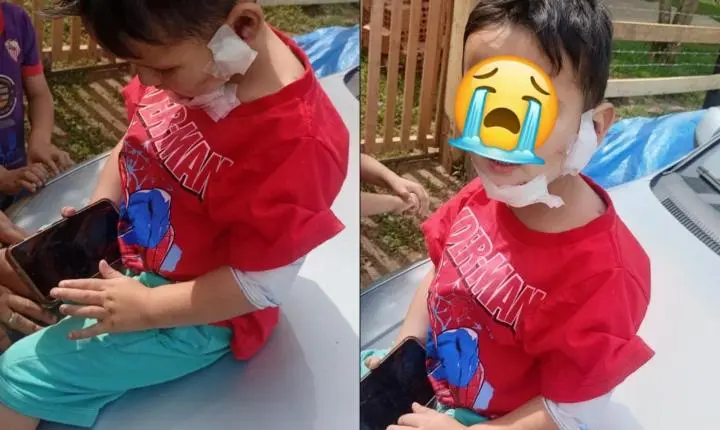 Menino de 3 anos é brutalmente atacado por cachorro em Campo Alegre