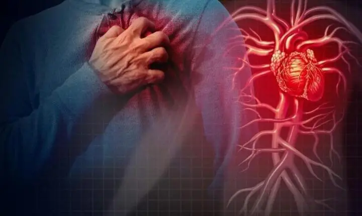 Nova lei amplia acesso a medicamento que pode salvar vidas em casos de infarto e AVC pelo SUS